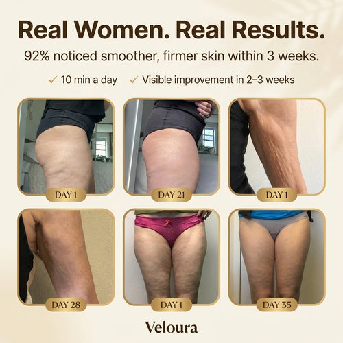 Veloura Firma™ Cellulite Massager